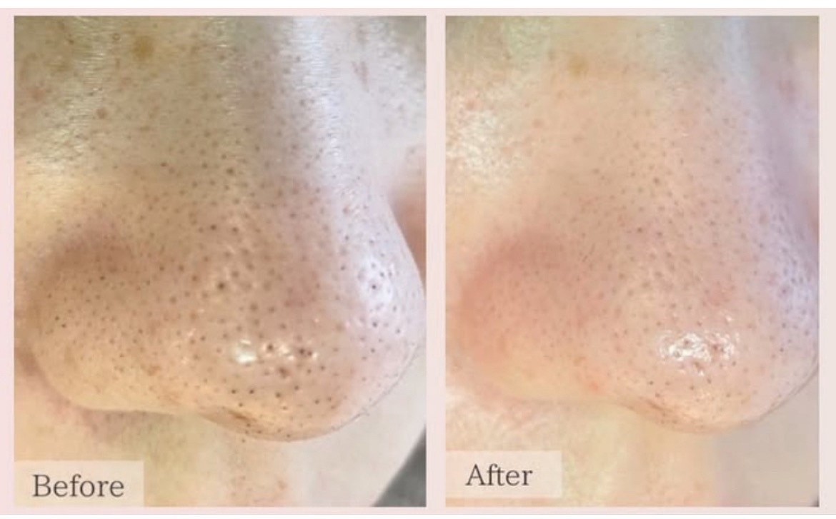 73bfb2b24d80a07b690c8da79805902c-1765158727.jpeg 73bfb2b24d80a07b690c8da79805902c-1765158727.jpeg